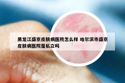 黑龍江盛京皮膚病醫院怎么樣 哈爾濱市盛京皮膚病醫院是私立嗎
