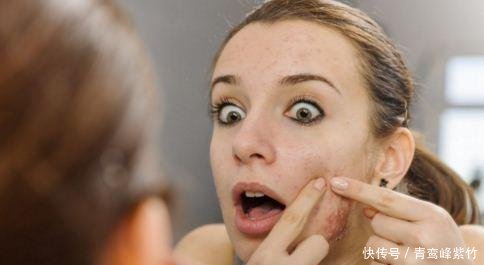 深圳膚康皮膚病研究院 治療痤瘡疤痕該注意什么