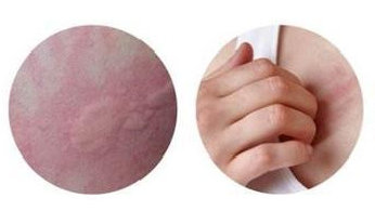 鄭州膚康中醫(yī)皮膚病研究院