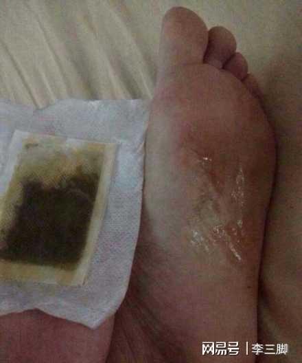 這4種產品,并沒有宣傳的那么 神奇 ,還可能有害,別買 護墊 被子 枕頭 皮膚科醫生 網易訂閱