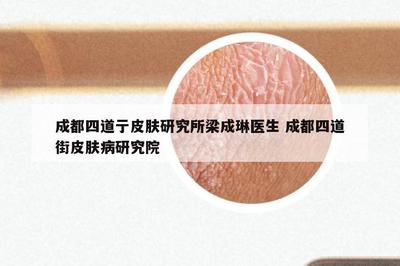 成都四道亍皮膚研究所梁成琳醫生 成都四道街皮膚病研究院