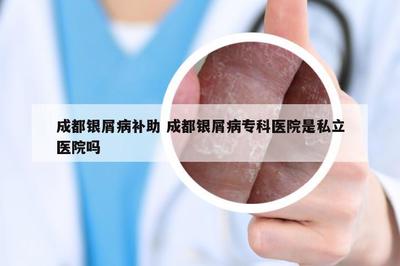 成都銀屑病補助 成都銀屑病專科醫院是私立醫院嗎