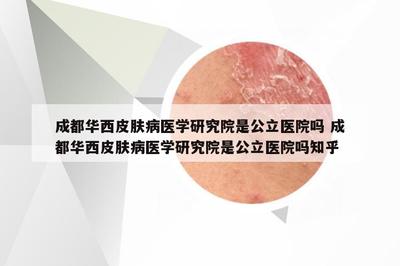 成都華西皮膚病醫學研究院是公立醫院嗎 成都華西皮膚病醫學研究院是公立醫院嗎