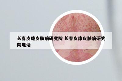 長(zhǎng)春皮康皮膚病研究院 長(zhǎng)春皮康皮膚病研究院電話