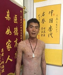 大醫(yī)精誠(chéng)承國(guó)粹 濟(jì)世救人煥新顏 記中醫(yī)治療皮膚病之大國(guó)工匠王益元