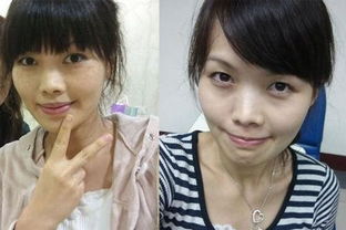 珍珠檸檬可以祛斑 專業人士一語道破,不加它們斑點很難去掉