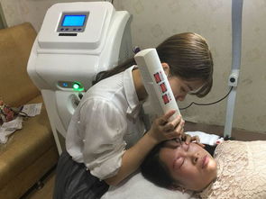 始元淑專業祛斑祛痘加盟優勢