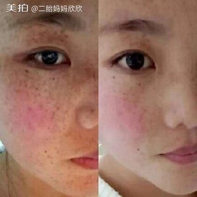 彩虹團隊顏面膜創始人