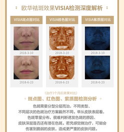 美顏套餐 eleen清斑套餐光子嫩膚 激光祛斑 美白 點擊查看 美妝博主專業祛斑方案 悅美整形