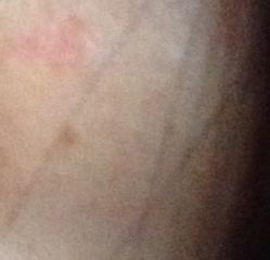 竟歐專業脫毛祛斑連鎖機構的全部評價