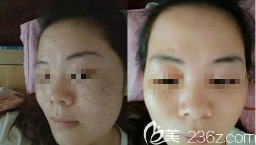 新版韓國排名前10整形醫生任職醫院案例價格公布 涵蓋眼鼻面部輪廓醫生