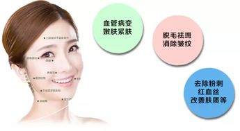 怎樣祛斑最有效 美容院祛斑小妙招分享