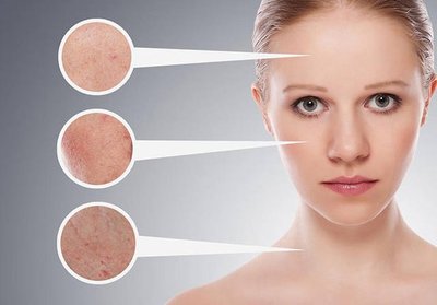 祛斑產品哪款最有效最安全 首選國家認可的祛斑產品