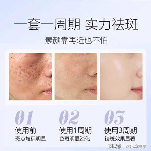 國家唯一認證的祛斑產(chǎn)品,夏日祛斑 淡斑祛斑效果排名第一護膚品