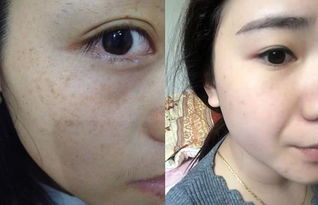 山上成片紅紅的花,每天堅持抹臉,十天淡斑去皺