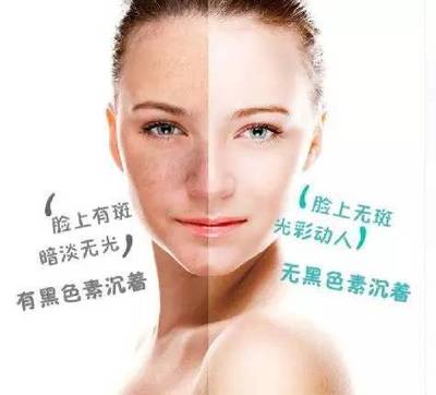 全城尋找50名免費(fèi)祛斑體驗(yàn)者,別做一“斑”的女人!
