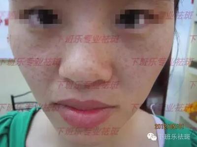 記者采訪下班樂創(chuàng)始人楊惠馨是如何祛斑的經(jīng)過-時尚頻道-手機(jī)