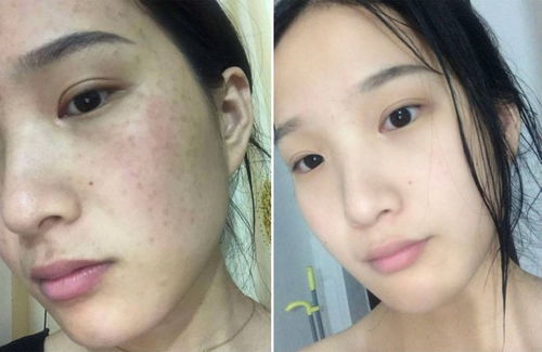 哪款產(chǎn)品祛斑效果好 最新分享 祛斑熱門十大品牌榜