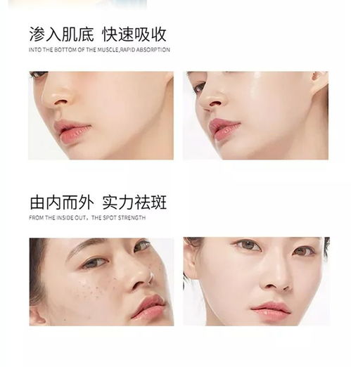 保濕祛斑霜正品黃褐斑雀斑曬斑妊娠斑老年斑各種色斑祛斑特證產(chǎn)品