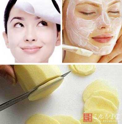 產后臉上長斑怎么辦?哪些方法能夠治療?