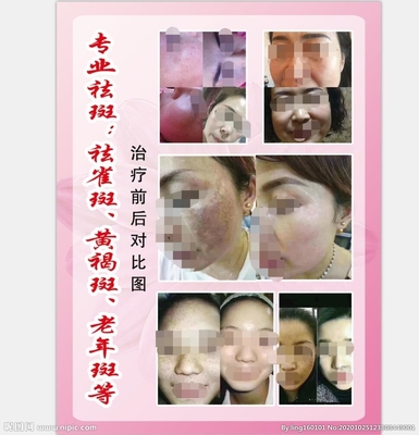 美容海報設計圖__PSD分層素材_PSD分層素材_設計圖庫