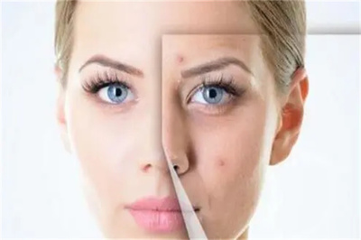 純中藥祛痘祛斑美白費多少錢?利潤如何