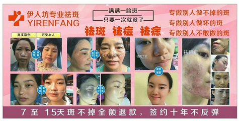 奕后美容 專業祛斑，讓肌膚重煥光彩