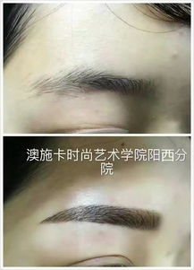 祛斑祛痘新篇章 慶祝翌芙萊專業祛斑祛痘陽西總店盛大開業