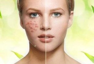 專業祛斑祛痘加盟連鎖項目 開啟美麗事業，共創健康肌膚未來