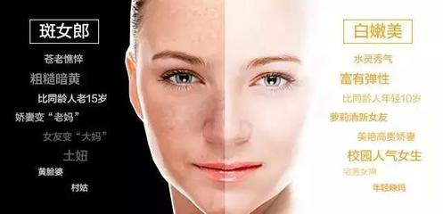 有效祛斑全攻略 專業淡斑祛斑小妙招