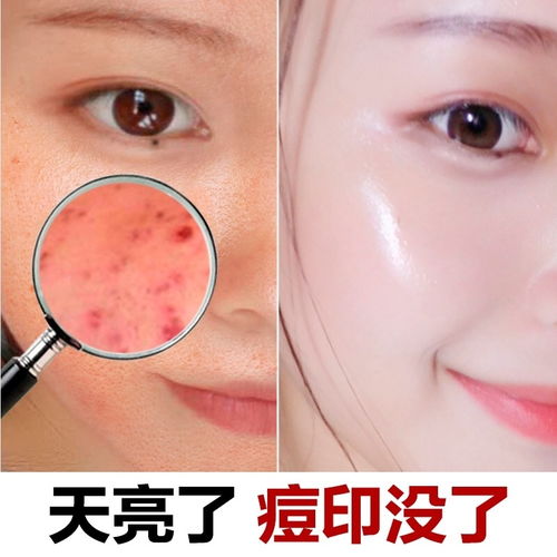美白祛斑去痘印，素顏霜神仙膏讓肌膚煥然一新